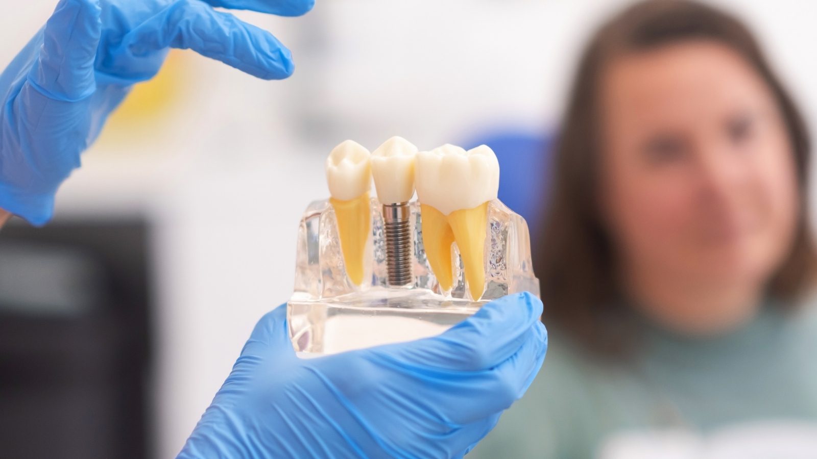 Un modèle de mâchoire présente un implant : la vis en titane et la dent qui se fixe dessus.